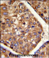 P4HB Antibody (C-term)